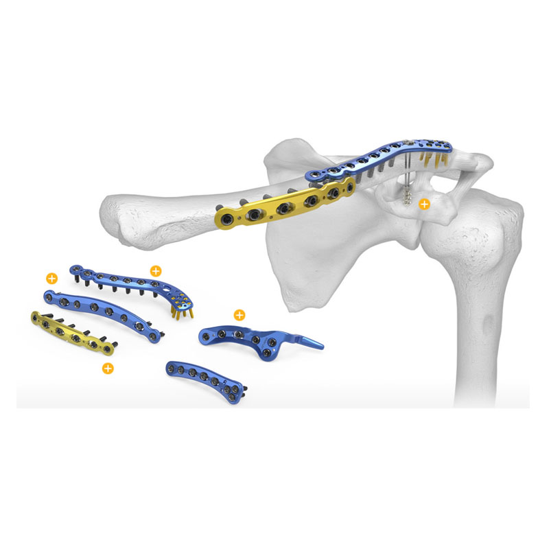 clavicle plate types