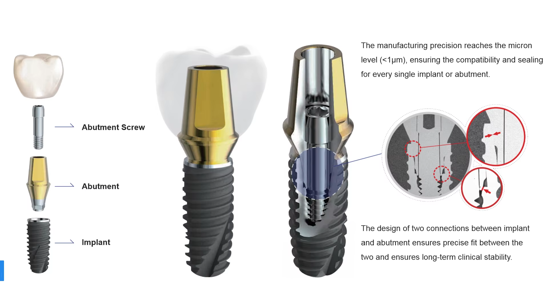 Dentium Abutment