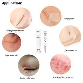 Reparação da cicatriz da ferida Gel de silicone médico para cicatriz