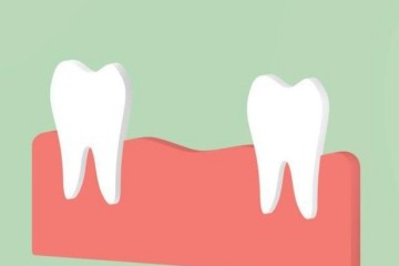Why do missing teeth have to be filled in time?