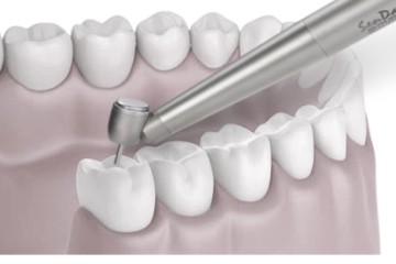 Todos os dentistas compram peça de mão cirúrgica de 45 graus