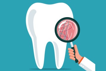 Những lưu ý sau khi phẫu thuật hàm giả cố định