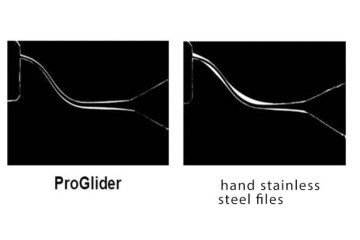 How to carry out safe and efficient root canal preparation?