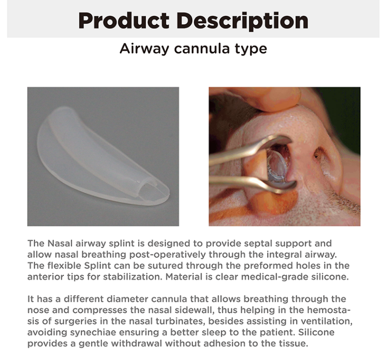 Silicone Internal Nasal Splint