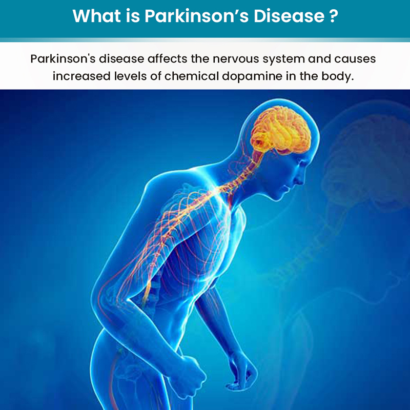 Mi az a Parkinson-kór? Milyen orvosi segédeszközökre van szükségük?