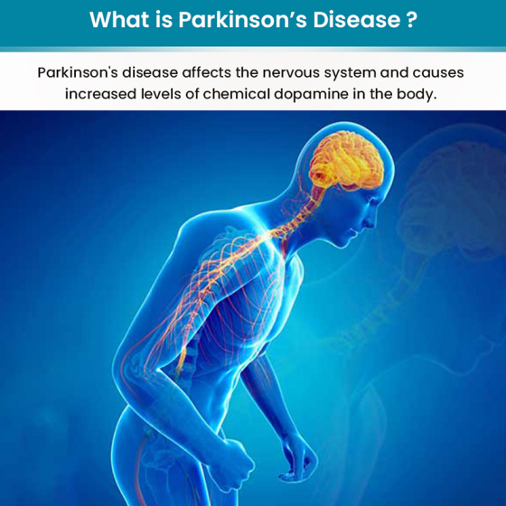 O que é a doença de Parkinson? De quais dispositivos de assistência médica eles precisam?