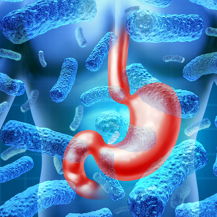 Clinical Application of Calprotectin Testing in Functional Gastrointestinal Disorders