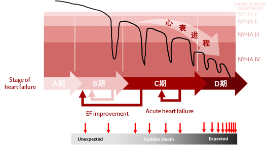 NT-proBNP heart failure detection