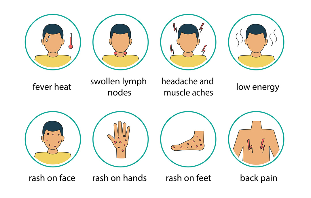 Monkeypox Symptoms.jpg