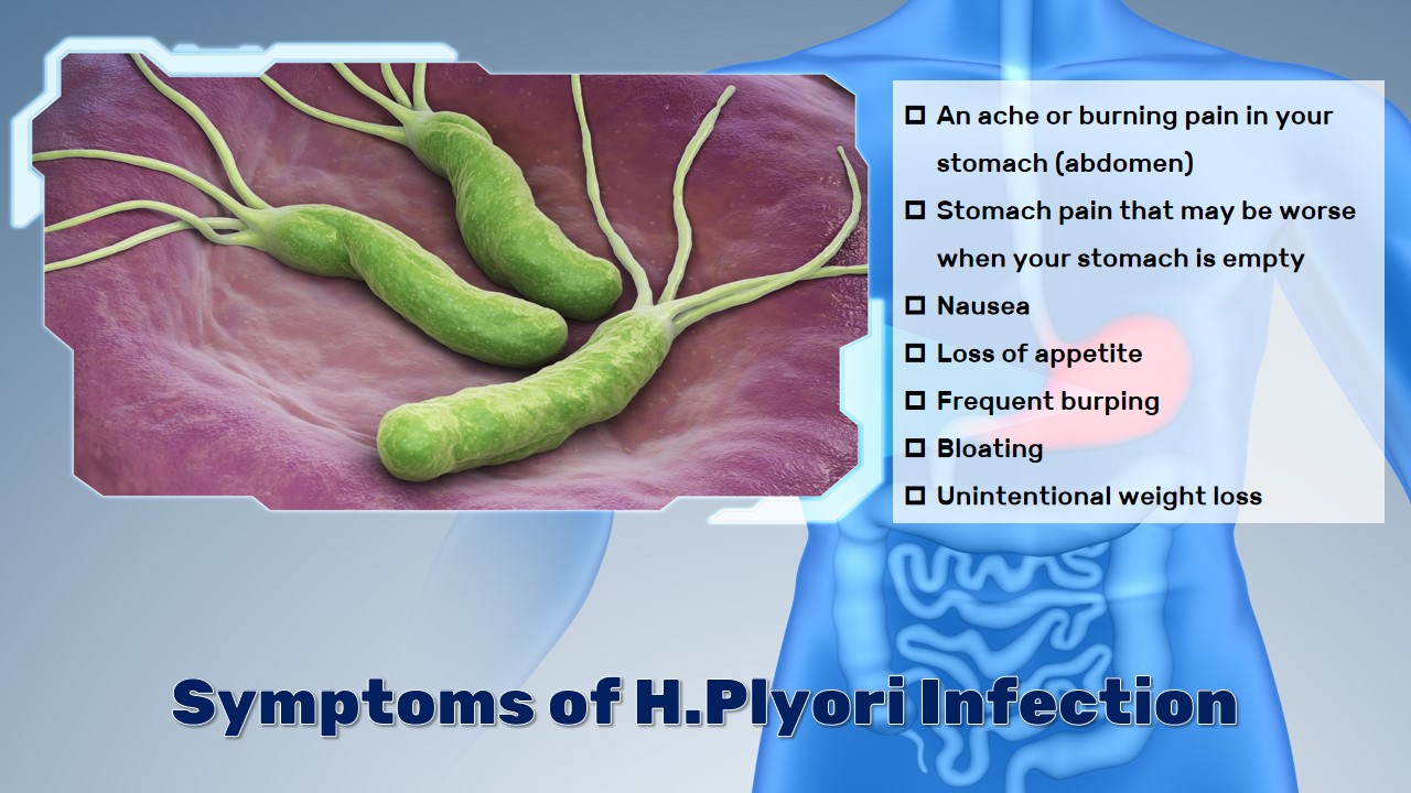 h.pylori test