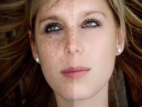 Why is the skin on the face not as good as the skin on the body?