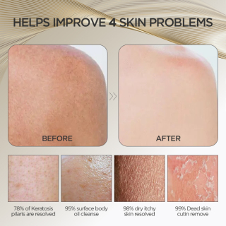 قفاز كيسا للتقشير بطبقة مزدوجة، قفاز مغربي مقشر تركي للنساء والرجال