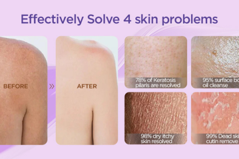 Benefits of Exfoliation for Sensitive Skin ?