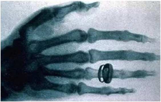 X-ray