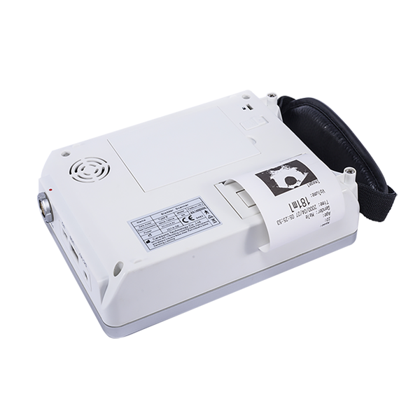 PadScan HD3 Blasenscanner