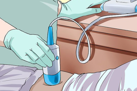 Klinische toepassing van draagbare blaasscanner