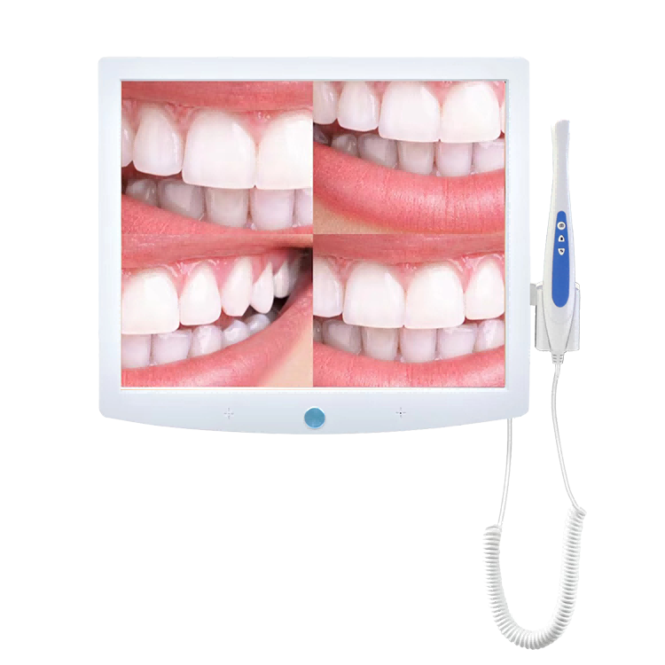Dental Oral Endoscope