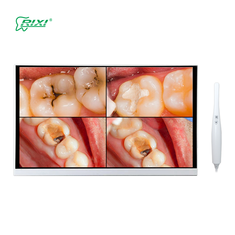 Supply Dental Periodontal Endoscope System Wholesale Factory Foshan