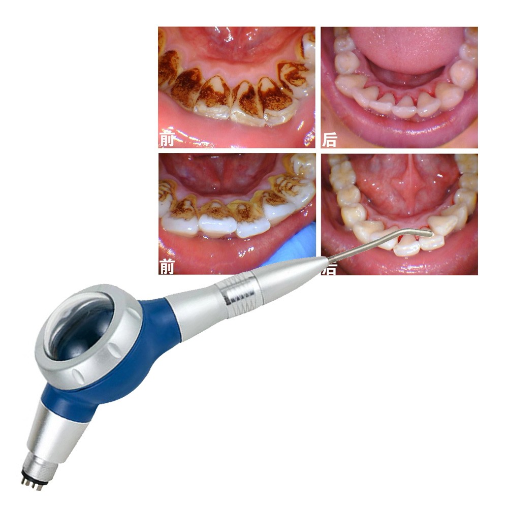 blue dental air polisher