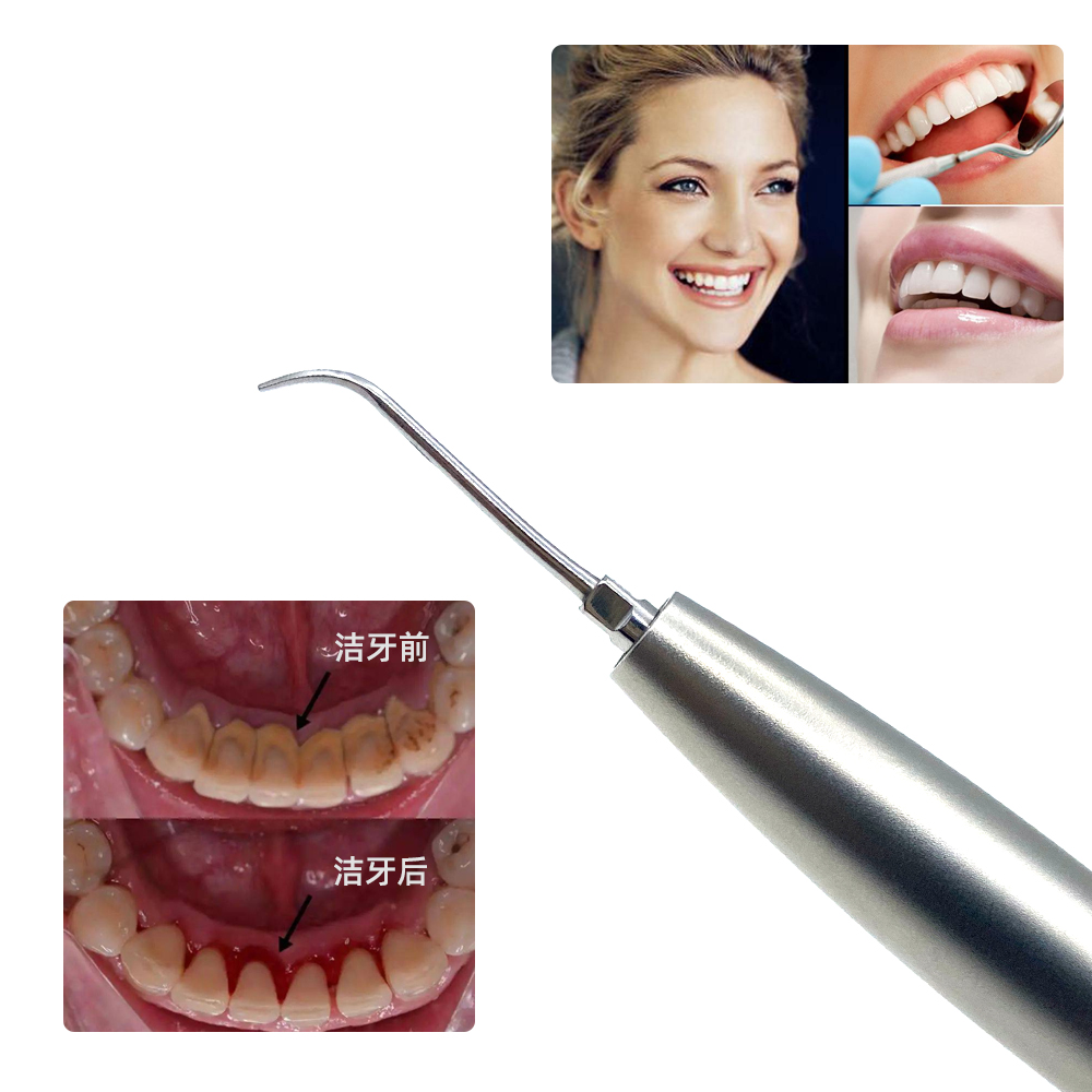 Acquista Scaler ad aria per irrigazione endodontica dentale,Scaler ad aria per irrigazione endodontica dentale prezzi,Scaler ad aria per irrigazione endodontica dentale marche,Scaler ad aria per irrigazione endodontica dentale Produttori,Scaler ad aria per irrigazione endodontica dentale Citazioni,Scaler ad aria per irrigazione endodontica dentale  l'azienda,