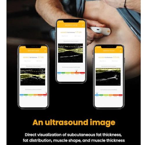Body Fat Scanner Portable Ultrasound Measurement With App
