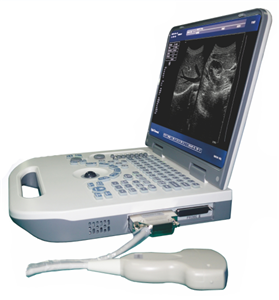 Notebook LED Digital Ultrasound Scanner S50A