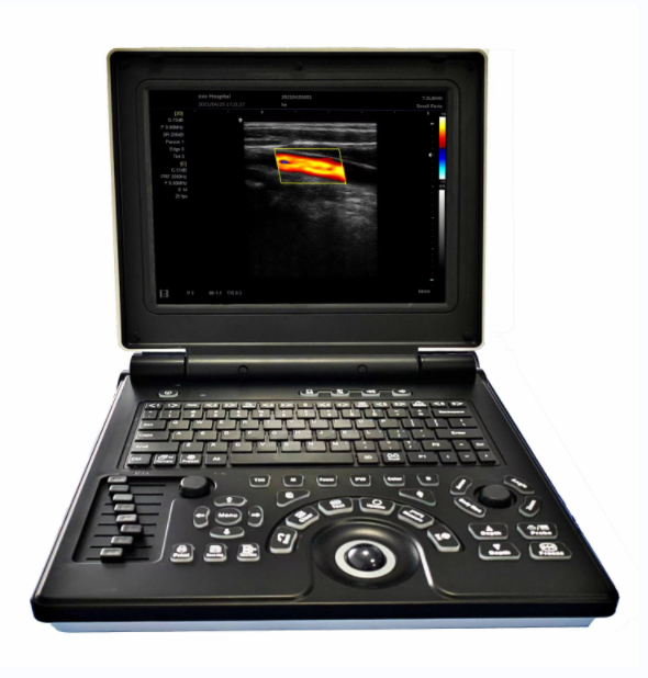 Notebook Color Doppler Ultrasonic Diagnosis System E20