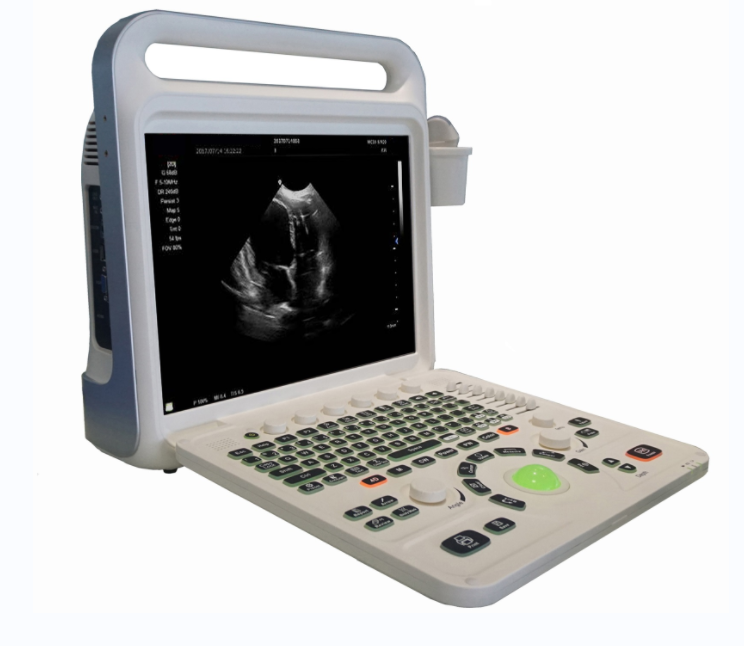 Color Doppler Ultrasonic Diagnosis System E60