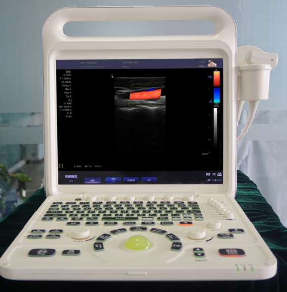 Color Doppler Ultrasonic Diagnosis System E60