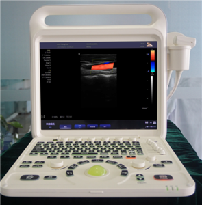 Système de diagnostic par ultrasons Doppler couleur E60