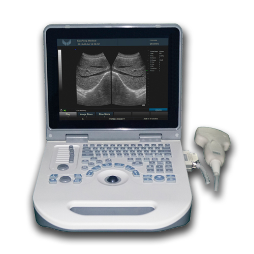 Notebook LED Digital Ultrasound Scanner S50A