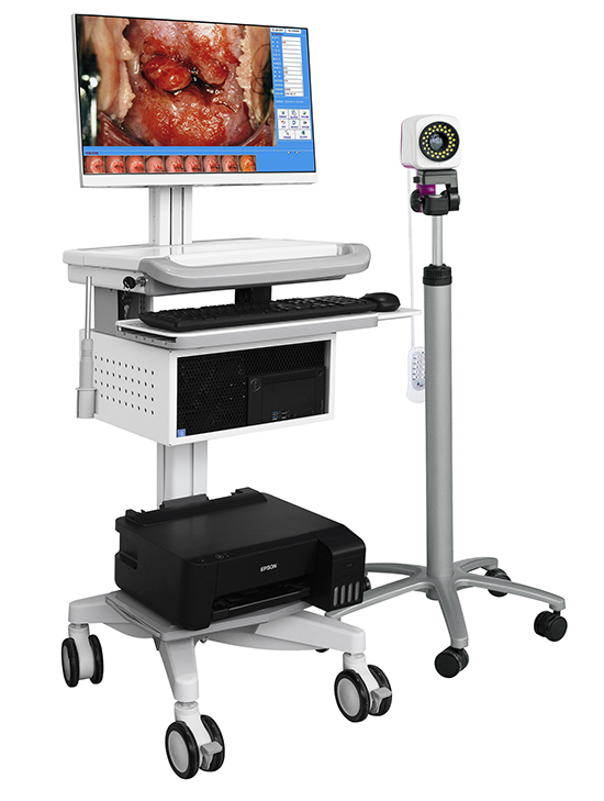 Electronic Colposcope (HD) JY-2650