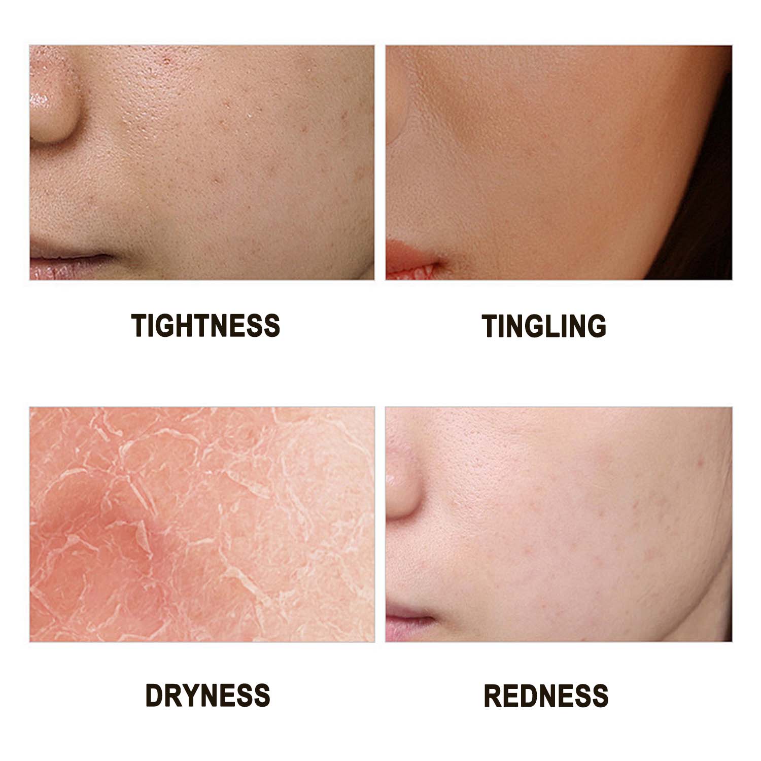 Recombinant Mussel Mucin Repair Dressing Launch: A Breakthrough in Skin Barrier Repair!