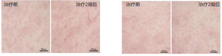 private label BAIOUMEI Rejuvenating Eye Cream
