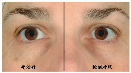 BAIOUMEI Rejuvenating Eye Cream manufacturer