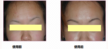 MANSI Sculpting & Wrinkle-Reducing Face Cream supplier