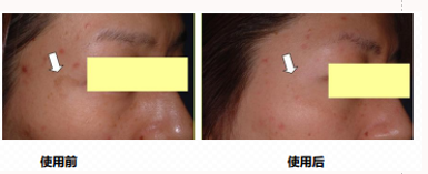 MANSI Sculpting & Wrinkle-Reducing Face Cream contract manufacturing
