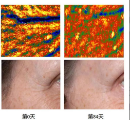 MANSI Sculpting & Wrinkle-Reducing Face Cream supplier
