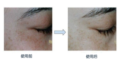 MANSI Luminous Dual Anti Serum bulk buyer