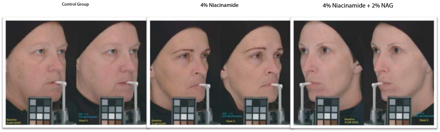 Acne-removing & Soothing Cream OEM Acne-removing & Soothing Cream OEM