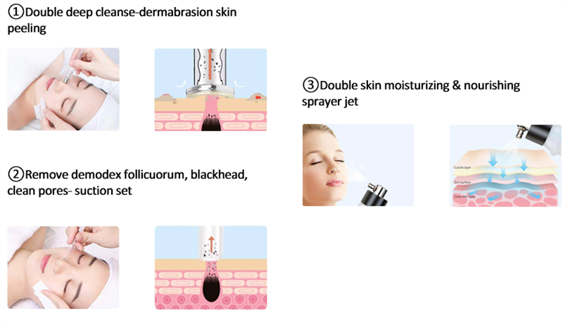 professional microdermabrasion machines