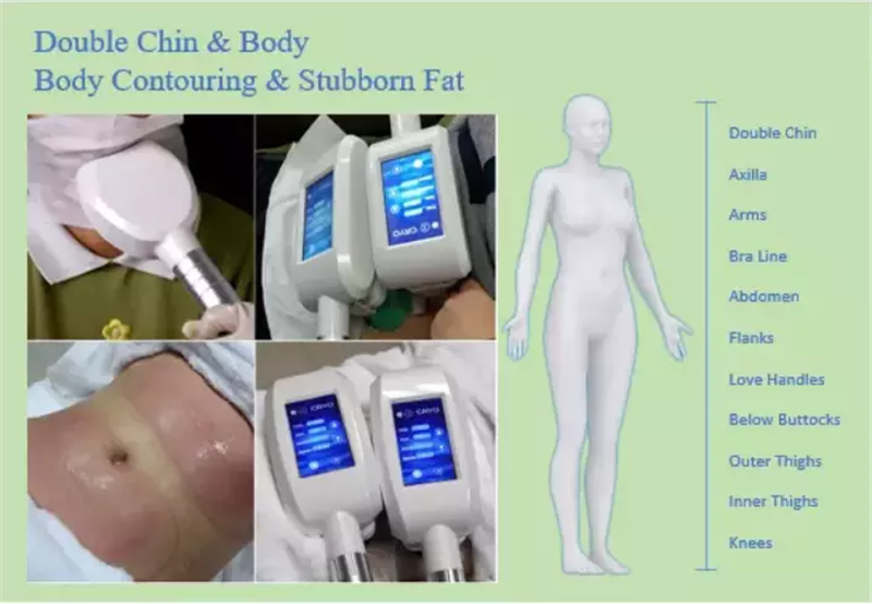 multifunction cryolipolysis machine