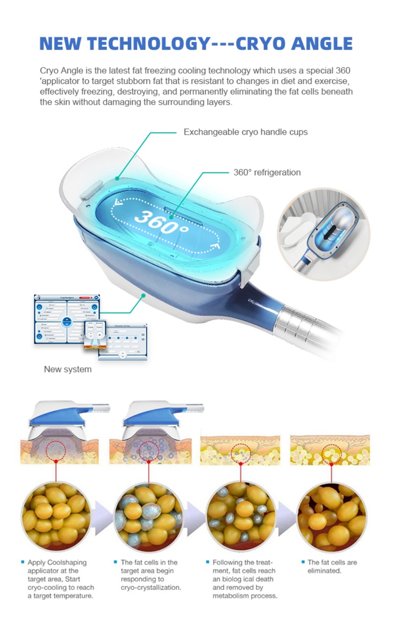 cryo fat freezing machine