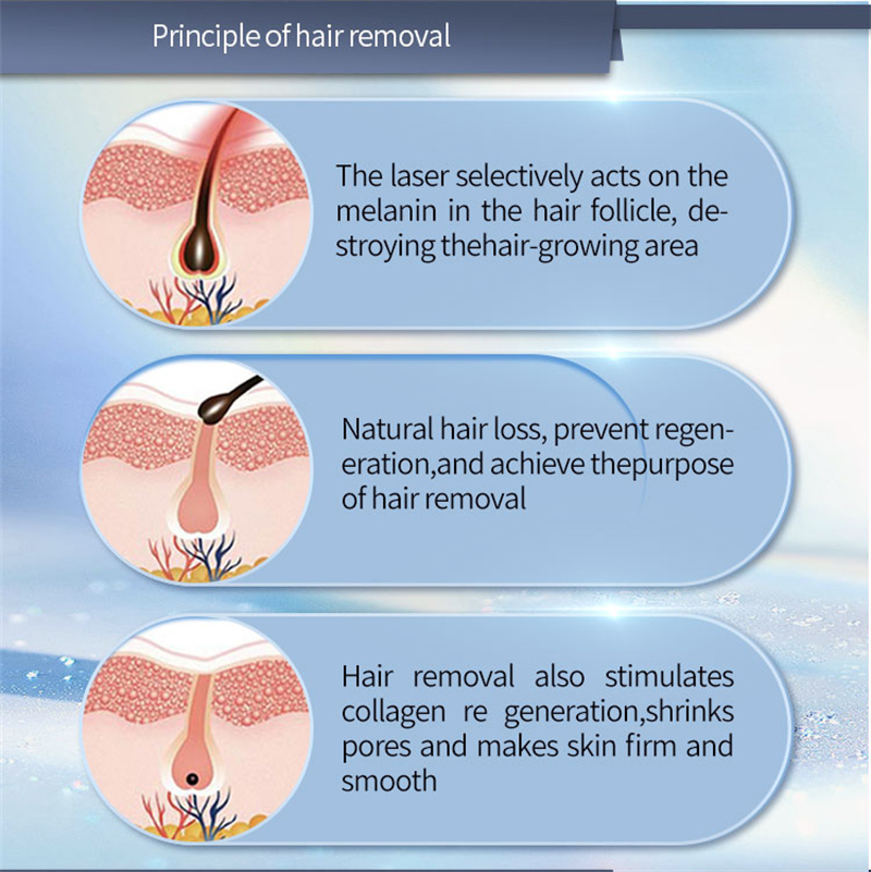 permanent hair removal machine