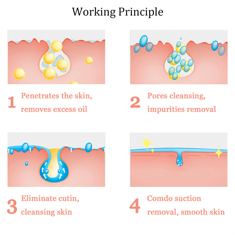 crystal microdermabrasion machine