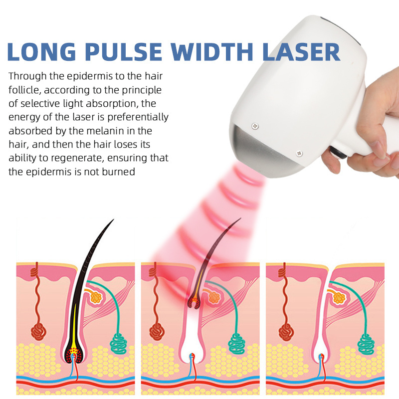 Laser Pico Tattoo And Body Hair Epilation Removal Machine
