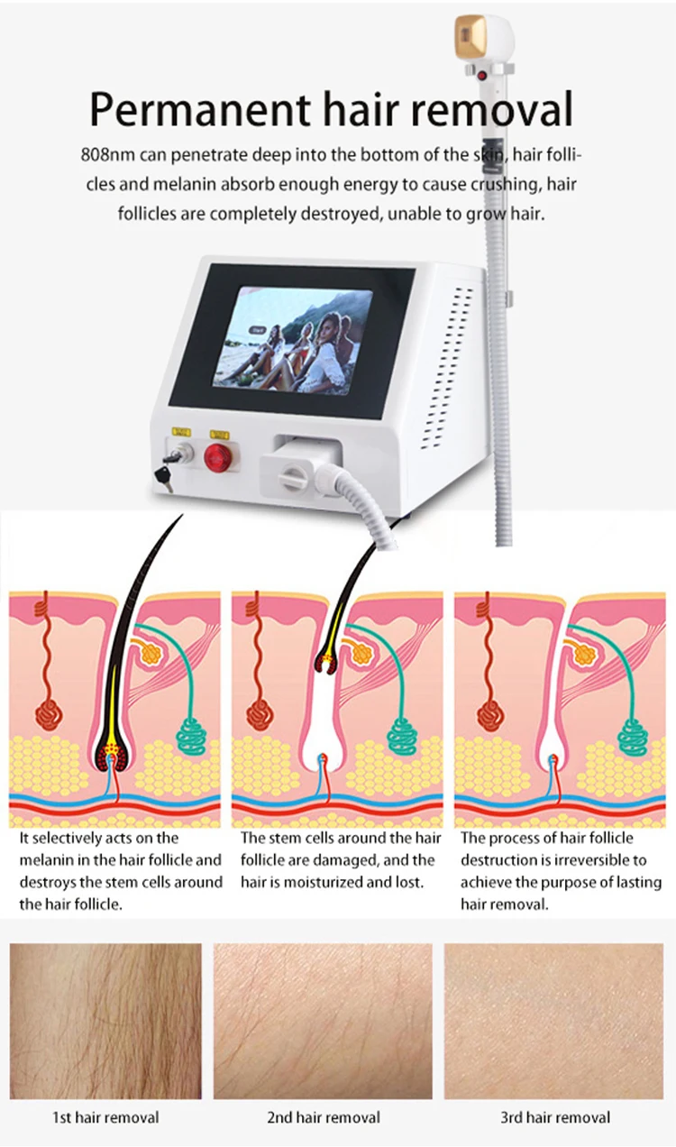 body hair removal machine