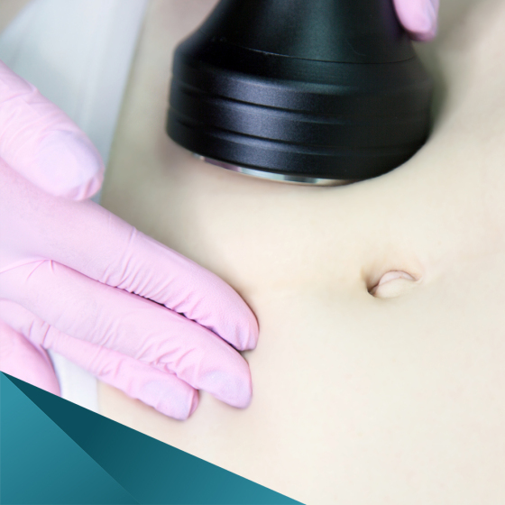 How do cavitation and RF lifting work?