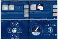 Аппарат для гидродермабразии Умный Лед Синий Кожа Управление Система
