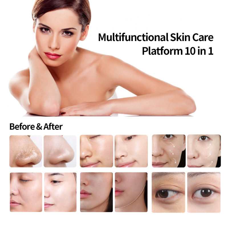 Hydrodermabrasion Dermabrasion Aquafacial Machine pour esthéticiennes